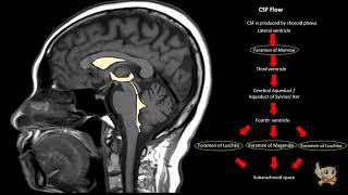 SFM Executive Committee Webinar Corpus Callosum [upl. by Stillmann]