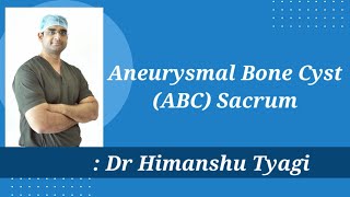 Aneurysmal Bone Cyst ABC Sacrum  TreatmentSurgery [upl. by Verine]