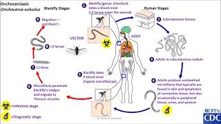 Onchocerca volvulus life cycle [upl. by Healion]