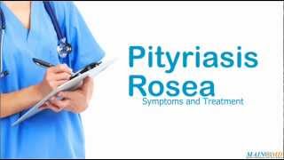 Pityriasis Rosea Symptoms and Treatment [upl. by Wendalyn805]