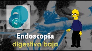 Endoscopia digestiva baja [upl. by Ylla102]