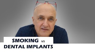 FAQ N°5 Smoking and dental implants [upl. by Funda]