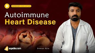 Autoimmune Heart Disease  Pathology Online Lectures  Medical Education  VLearning [upl. by Lay]