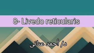 8 Livedo reticularis 👉 Dr Ahmed Anany [upl. by Spieler]