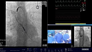 Lifetime management  Tailoring treatment options to secure future possibilities  GulfPCRGIM 2023 [upl. by Letisha]