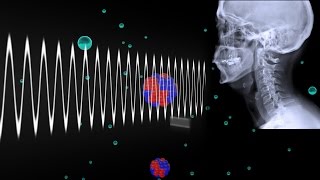 How Do Xrays Work [upl. by Nalyk488]