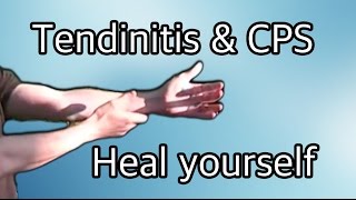 exercises for tendinitis tendonitis and carpal tunnel cps [upl. by Waldron]