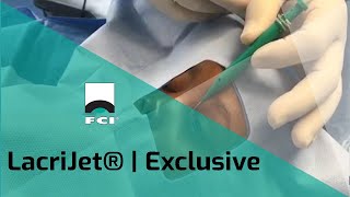 LacriJet®Preloaded amp SelfRetaining Monocanalicular Nasolacrimal IntubationExclusiveFCI Lacrimal [upl. by Israeli]