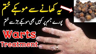 Warts Treatment  Mokon Aur Masson Ka Asan Ilaj  Hakeem Zia Shahid [upl. by Eseerahs59]