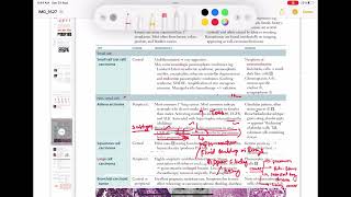 Adenocarcinoma Respiratory 54  First Aid USMLE Step 1 in UrduHindi [upl. by Nnanerak625]