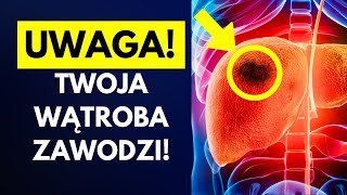 10 objawów że Twoja wątroba przestaje działać [upl. by Fasto644]