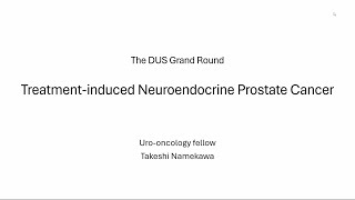 TreatmentInduced Neuroendocrine Prostate Cancer From Basic Research to Clinical Management [upl. by Janetta]