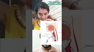 Tracheostomy amp tube youtubeshorts medical [upl. by Ahsi257]