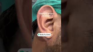 Otoplasty surgeey for ear reshaping of prominent ears in Pakistan otoplasty otoplastysurgery [upl. by Mirna]