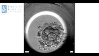 PreImplantation Embryo from Fertilization [upl. by Cathyleen]