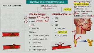 Enfermedad cerebrovascular [upl. by Harty]