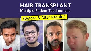 Hair Transplant  Patient Reviews  Medlinks  Before amp After Results  Multiple Client Testimonials [upl. by Llennhoj]