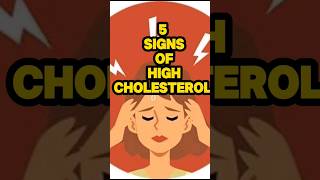 5 signs of high cholesterol healthyfood shorts [upl. by Ahsiele895]