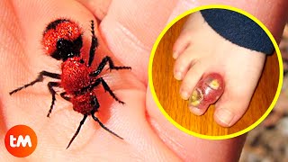 The WORST INSECT BITES In The World 😫🐝 [upl. by Alym]