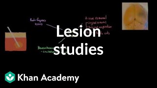 Lesion studies and experimental ablation  Organ Systems  MCAT  Khan Academy [upl. by Fitts848]