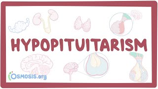 Hypopituitarism  causes symptoms diagnosis treatment pathology [upl. by Kcirednek]