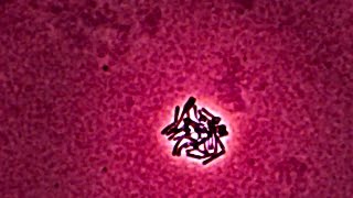 Lactobacillus  Time Lapse Photography [upl. by Fabrianne]