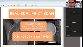 CASNRADIOGRAFER EPS 54  REAL SOAL FR CT SCAN  pppkradiografer skbradiografer fieldreport [upl. by Annaj]