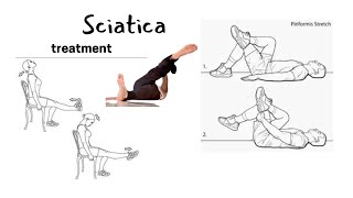 Nerve GlidingFlossing Exercises for Sciatica [upl. by Ecnerwaled513]