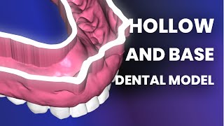 How to Hollow and Base Dental Model for 3D Printing [upl. by Orianna]