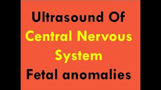 Ultrasound of CNS foetal anomalies [upl. by Anele659]