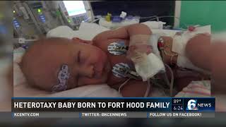 Heterotaxy baby born to Fort Hood family [upl. by Perce]