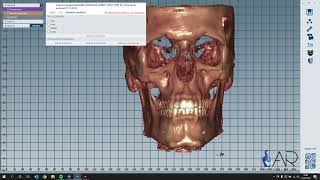 DICOM VIEWER en exocad [upl. by Naxor]