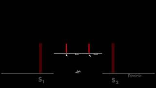 Normal Heart Sounds [upl. by Ennairac]