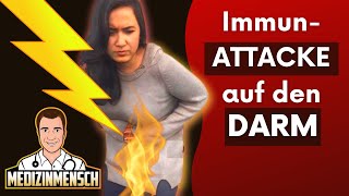 Reizdarm Oder ATTACKIERT das Immunsystem Bauchschmerzen Ursache erkennen Arzt erklärt [upl. by Aserret]