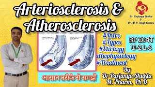 Arteriosclerosis and Atherosclerosis  Intro Types Etiology Pathophysiology BP 204T U2 L6 [upl. by Ettenot]