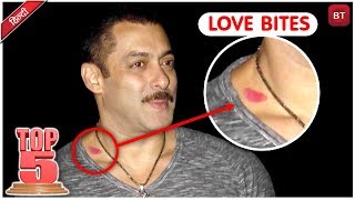 Bollywoods Top 5 Actors Who Flaunted Their Love Bites  Bollywood Actors Love Story [upl. by Renner]