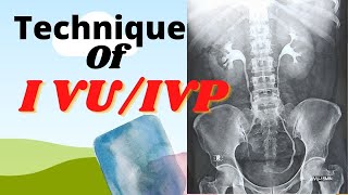 Technique of IVUIVP Ep36 Intravenous urogrampyelogram Procedure of IVUIVP test [upl. by Anaik]