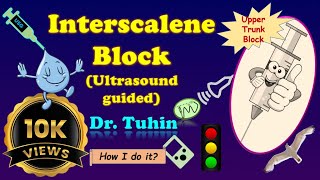 UltrasoundGuided Interscalene Brachial Plexus Block [upl. by Eeclehc]