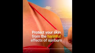 Natural Polyphenols for Sunburn Relief amp Other Skin Conditions [upl. by Shelagh]