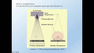 GRID Radiografi [upl. by Gnuj185]