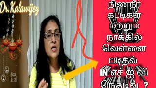 Multiple Swollen lymph nodes and white coating with negative HIV Test Indicate What In Tamil [upl. by Fionna]