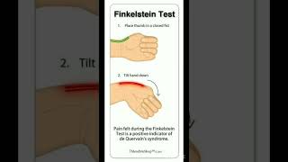 Finkelstein test viralshort allaboutnorcet medicaleducation biology nursingofficer [upl. by Verdha]