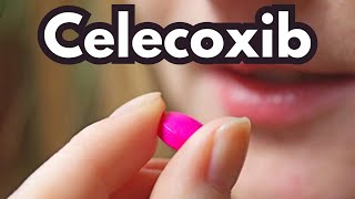 HOW TO PRONOUNCE CELECOXIB correctly with a british accent [upl. by Josler591]