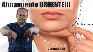 Lipopapada  Bichectomía  AFINAMIENTO FACIAL ❤️ ¿Qué Es Afinamiento De Rostro ⭐ Dr ALBERTO CALVO [upl. by Cogn]