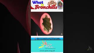 What is Bronchitis I Causes Of Bronchitis I Gaseous Exchange I Biology [upl. by Nna814]