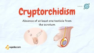 Cryptorchidism  Undescending Testicles  Causes Pathology  Pediatrics Video Lecture [upl. by Kablesh]