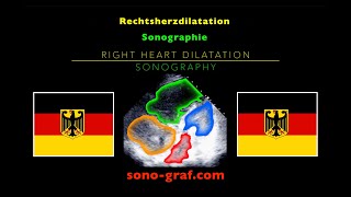 Echokardiographie  Rechtsherzdilatation [upl. by Anitselec]