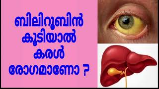 Does high bilirubin always mean liver disease Malayalam [upl. by Dysart]