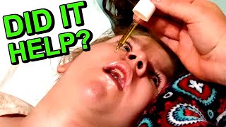 I gave her CBD oil for a week and this is what happened [upl. by Anawik]