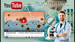 Beat the Itch A Complete Guide to Conquering Tinea Versicolor [upl. by Gaile]